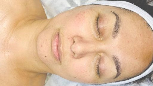 This is our signature facial treatment which includes a beautiful face, neck and shoulder massage. Woman having treatment with towel around head